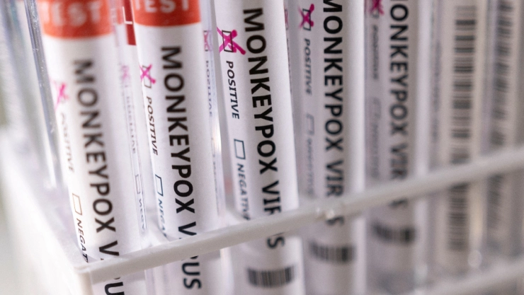 viruela del mono no es pandemia