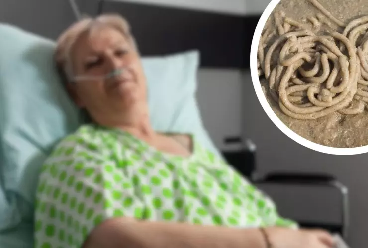 Fallece mujer en Campeche por miasis; autoridades emiten alerta sanitaria