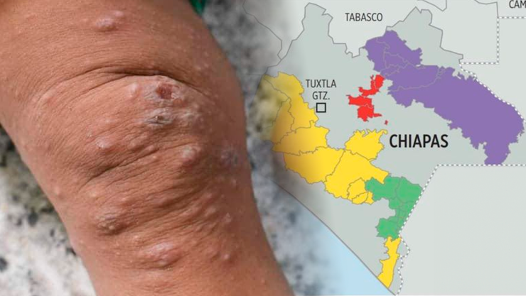 Virus del Mono en Chiapas