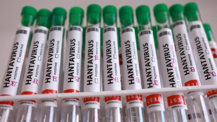 Hantavirus