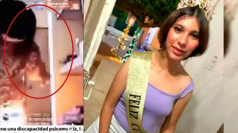 Joven muere quemar su cuerpo