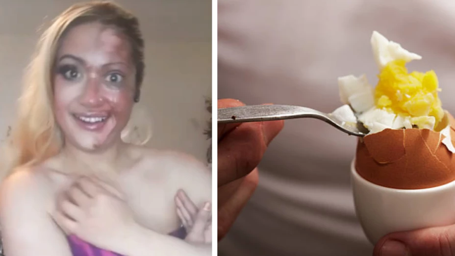 VIDEO_ ¡Cuidado con los hacks de Tik Tok! Mujer se quema la cara