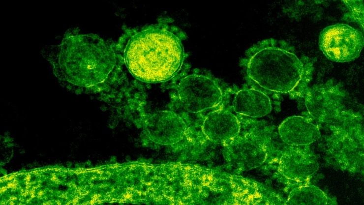 Klebsiella-oxytoca-así-se-transmite-la-bacteria-detectada-en-hospitales-de-Edomex