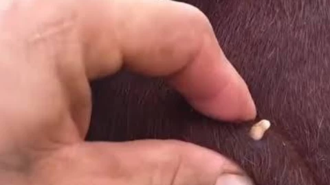 casos humanos de gusano barrenador.png