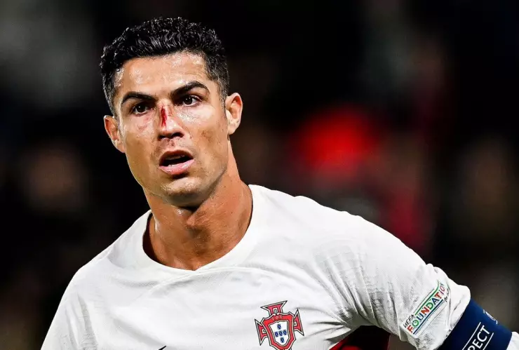 Cristiano Ronaldo sufre golpe