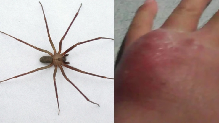 Temporada de araña violinista 2025: ¿Cuándo es y qué hacer ante una mordedura?