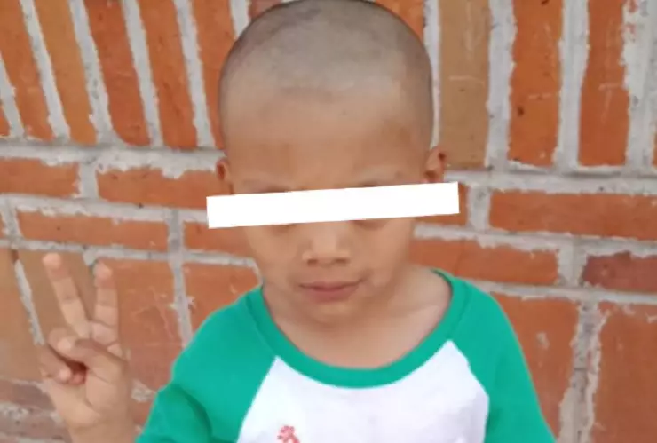 Niño se queda calvo por peinado loco