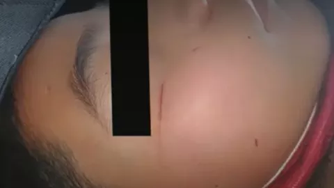 Profesor estrangula a alumno por salpicarle agua; lesionó su columna.