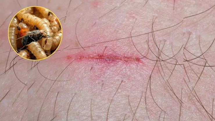 Casos de miasis por Gusano Barrenador en México 2025: ya son 48 afectados