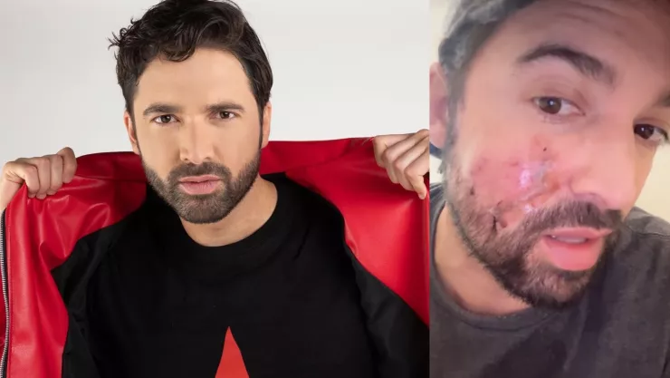 Carlos Girón enfrenta ataque de un perro y se somete a cirugía