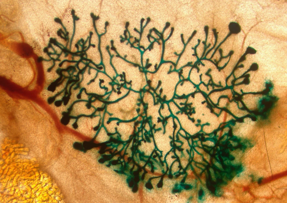 Las células cancerosas hibernan para evadir la quimioterapia