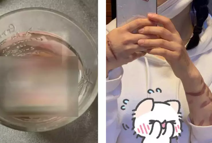 Mujer caníbal comparte videos comiéndose ella misma