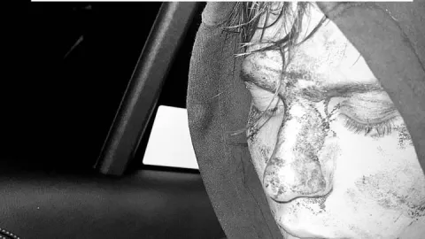 Amigo de Yeri Mua todo golpeado.