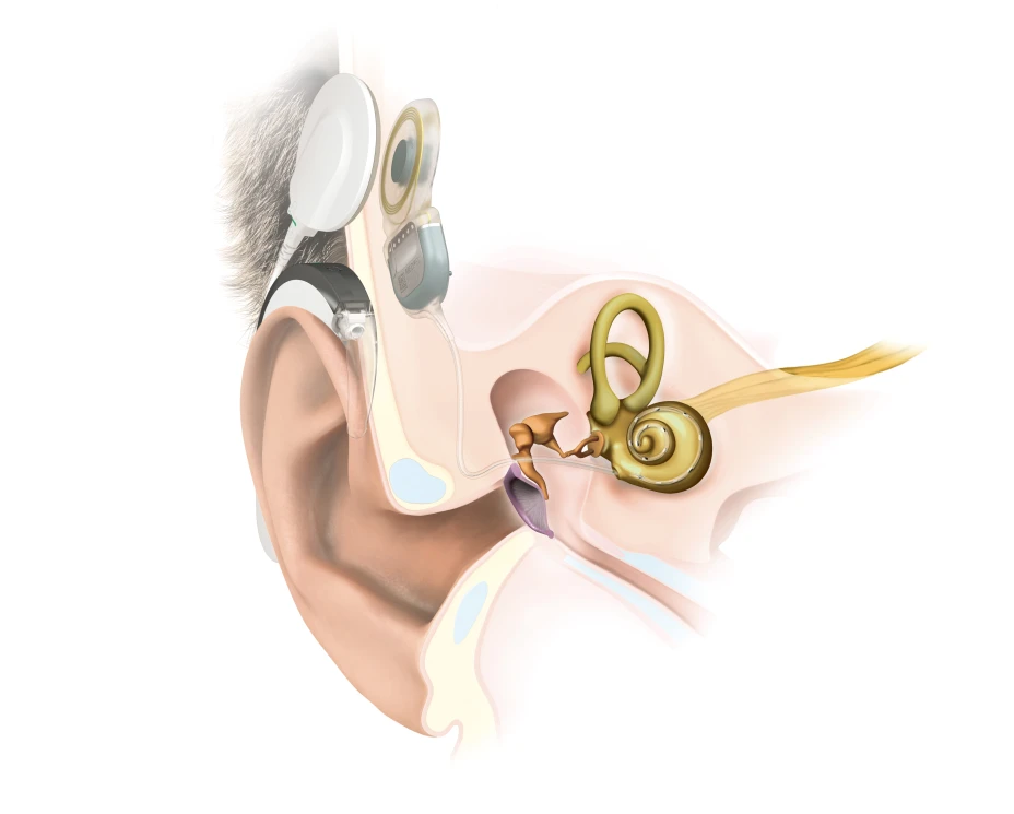 Anatomía de SYN 2 con SONNET 2.jpg