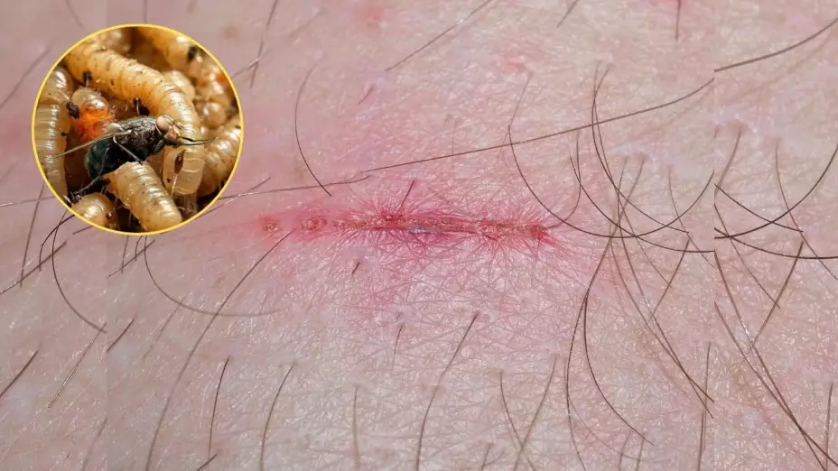Casos de miasis por Gusano Barrenador en México 2025: ya son 48 afectados