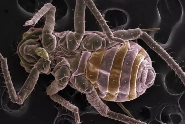 infestación de piojos