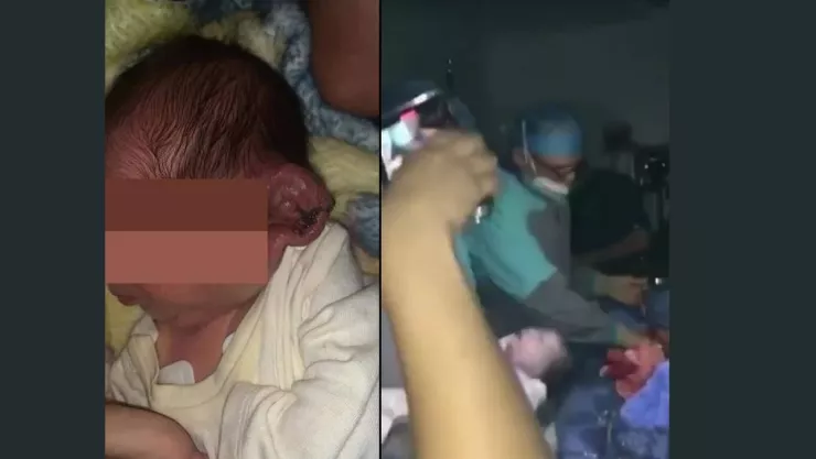 Cortan oreja a bebé en Mexicali