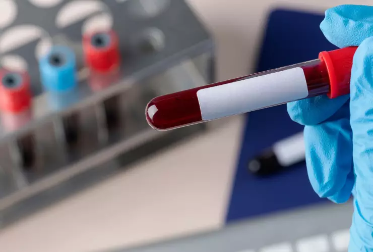 ¡Alerta! Aumentan más de 3 mil nuevos casos de VIH en actual administración de Baja California.jpg