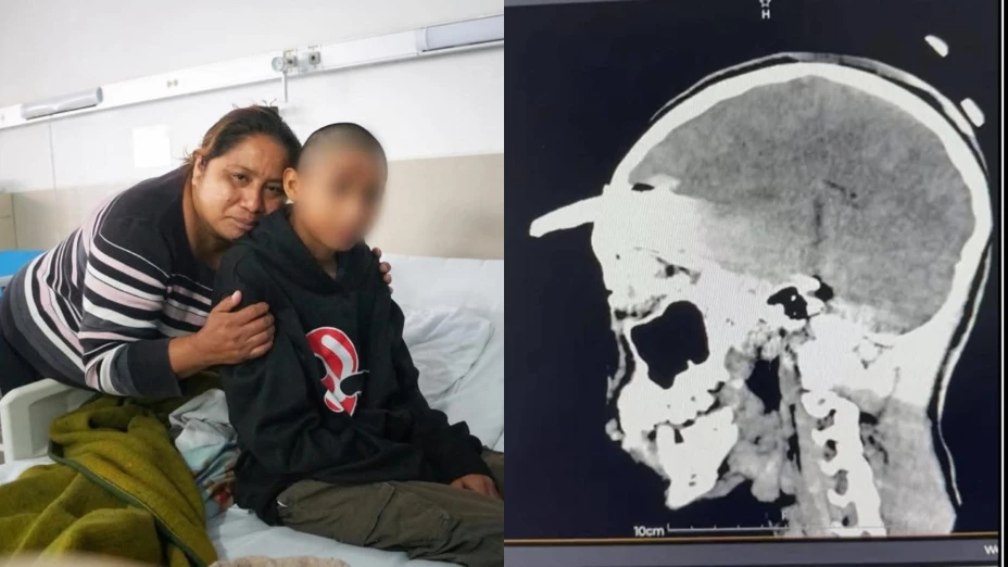 Operación SALVA LA VIDA de joven en Yucatán; tenía una coa INCRUSTADA en el cráneo