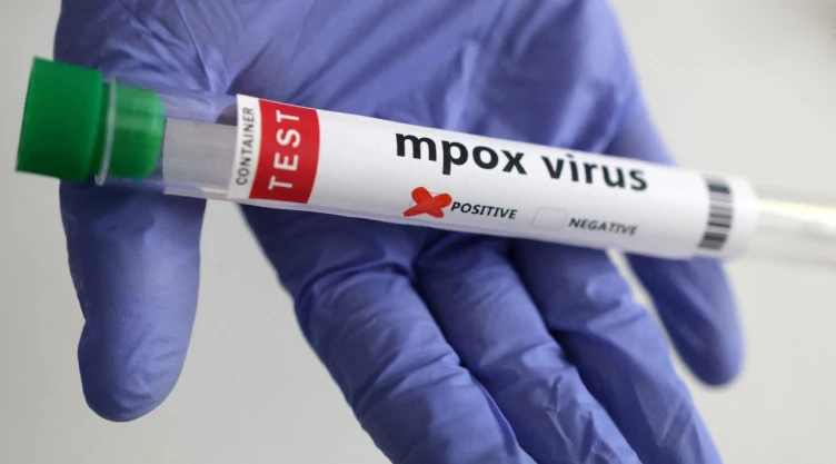 viruela-del-mono-mpox-reino-unido