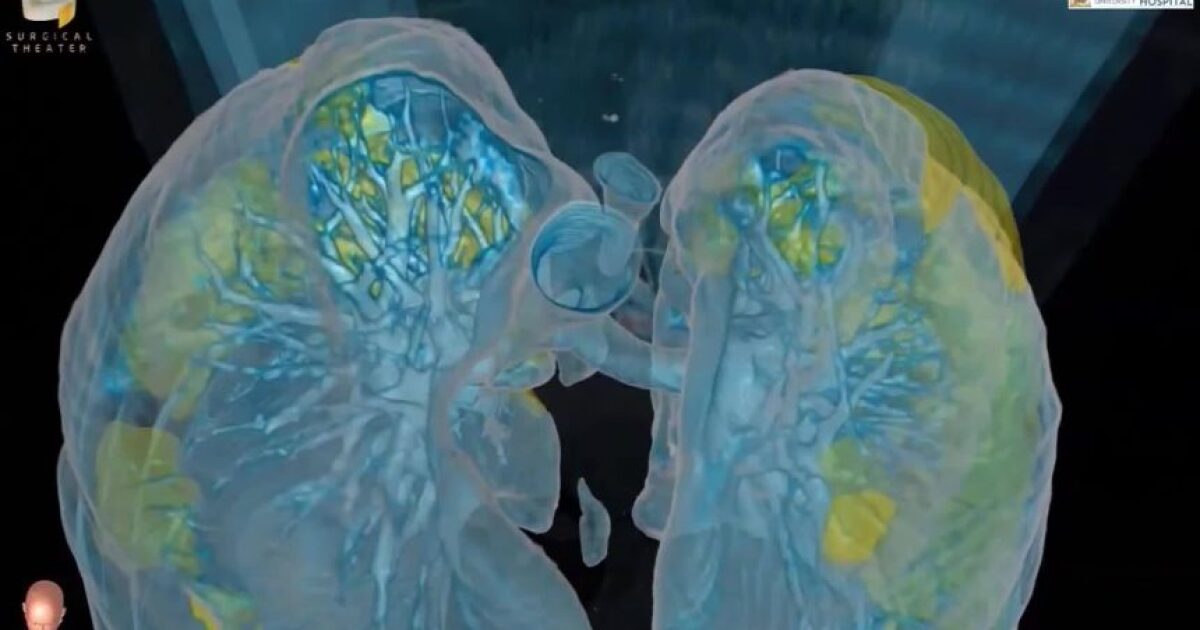 fisiopatología hipertensión arterial medicamento
