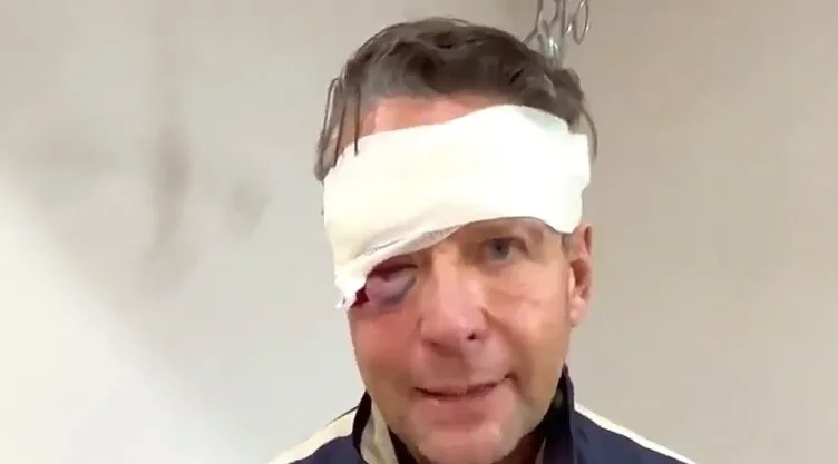 Alfredo Adame preocupa al aparecer con la cara inflamada