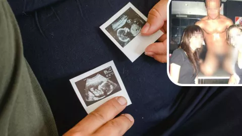 ¡Insólito! Quedó embarazada en su despedida de soltera; el papá era un stripper enano