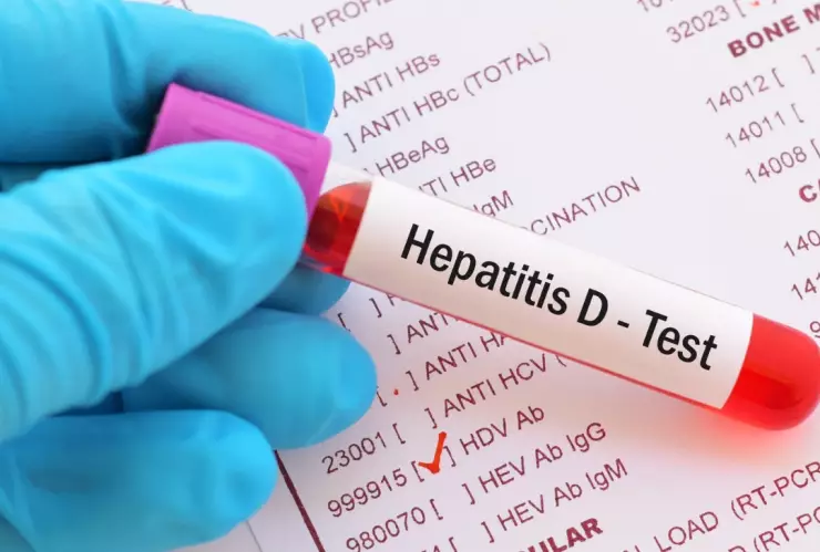 ¿Por qué la hepatitis D es la más peligrosa?