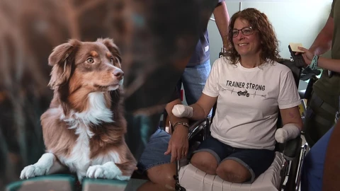 Le amputan piernas y manos porque perro la lamió.jpg