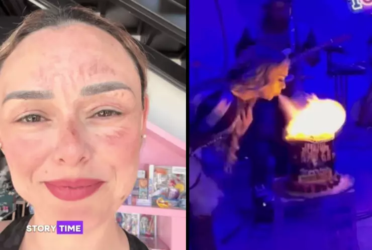 Así quedó el rostro de la influencer que se quemó por hacer un trend viral.png