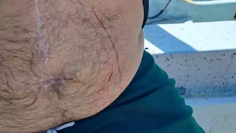 ATAQUE de lagarto contra pescador en Dzilam de bravo (FOTO)