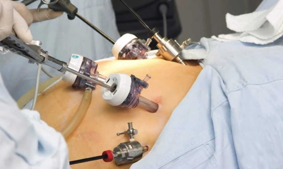 Un estudio reveló que si una madre obesa se somete a una cirugía reductiva, sus hijos podrían ser menos obesos