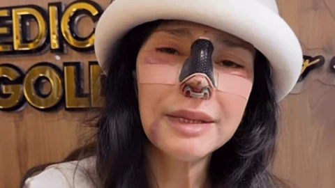 ¿Qué es una cámara hiperbárica La misma a la que entró Dorismar al tener su rostro desfigurado.png