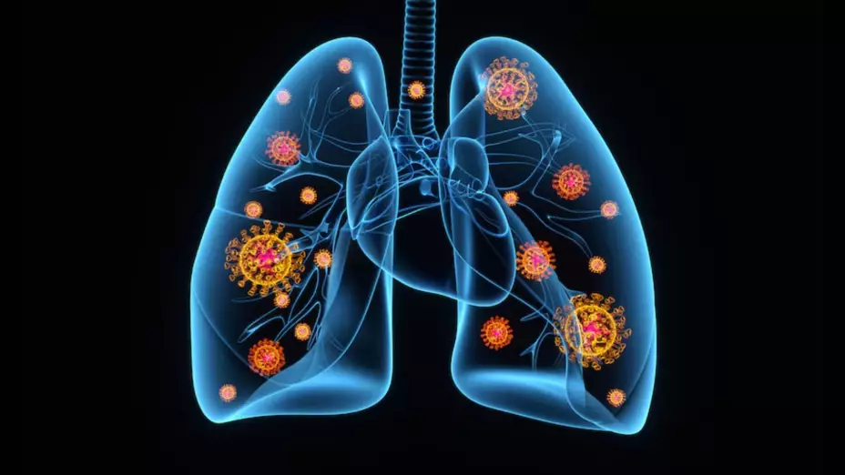 Confirman primer caso de metapneumovirus humano