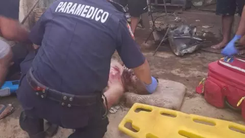 Explosión de tanque de gasolina en Peto deja un hombre gravemente herido