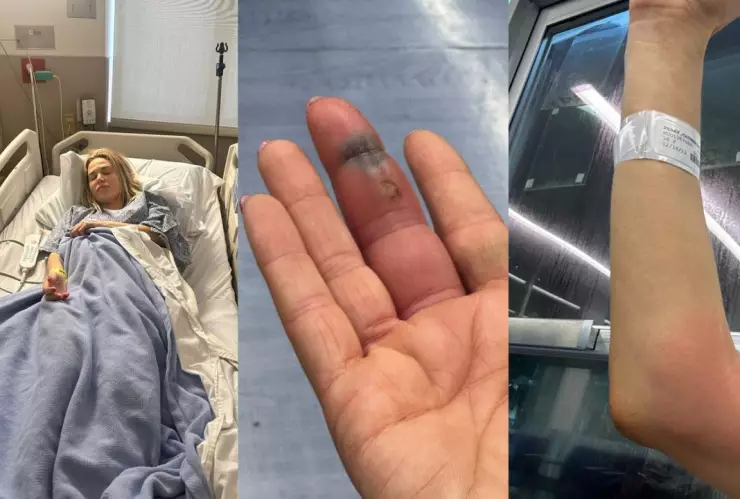 CJ Perry infección de dedo