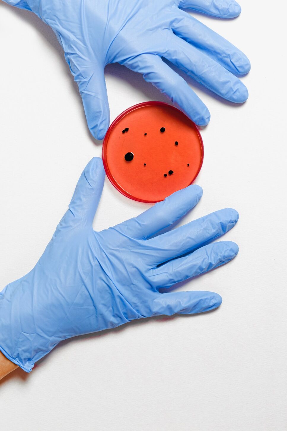 Virus Nipah