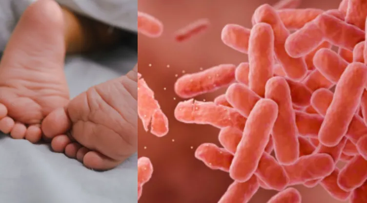 Bacteria Klebsiella en Durango: síntomas, riesgos y cómo afecta a recién nacidos