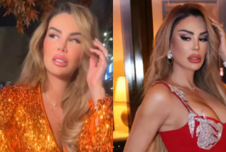 /famosos/ninel-conde-cambio-color-ojos-cuantos-millones-costo-operacion-pb-notas