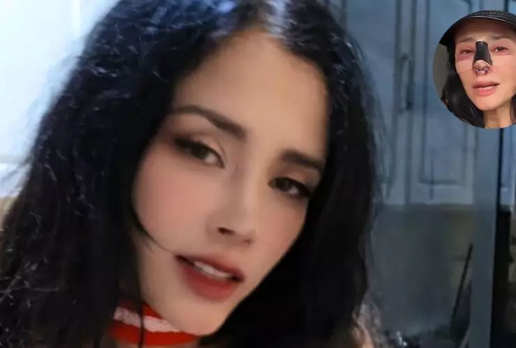 El mensaje de alivio de Dorismar tras iniciar proceso de recuperación de su nariz.jpg