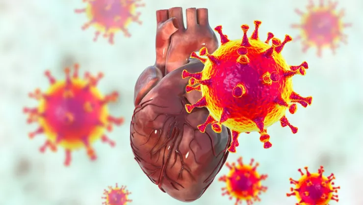 Daños al corazon por COVID 19