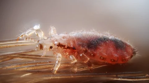 Muere niña de 9 años por infestación de piojos; tenía anemia