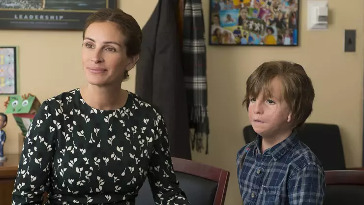 ¿Qué es el síndrome de Treacher Collins? Así funciona la enfermedad que inspiró la película ‘Extraordinario’