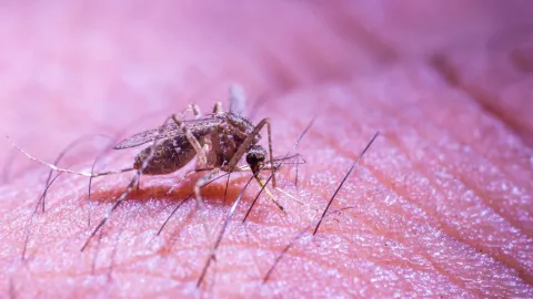 Enfermedad en la piel por picadura de mosquito en México: Leishmaniasis