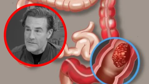 ¿Qué enfermedad tenía el actor James Van Der Beek? El diagnóstico que le arrebató la vida al protagonista de “Dawson’s Creek”