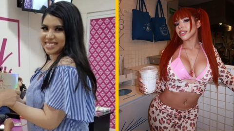 yeri mua antes y después de sus operaciones