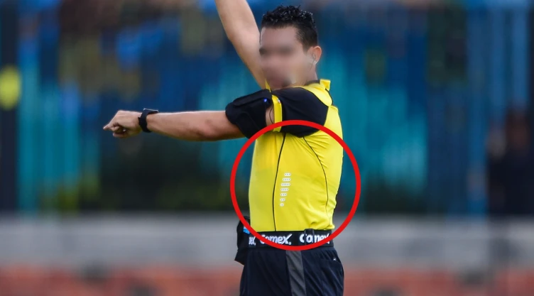 Árbitro, Liga MX, Diego Montaño, liposucción
