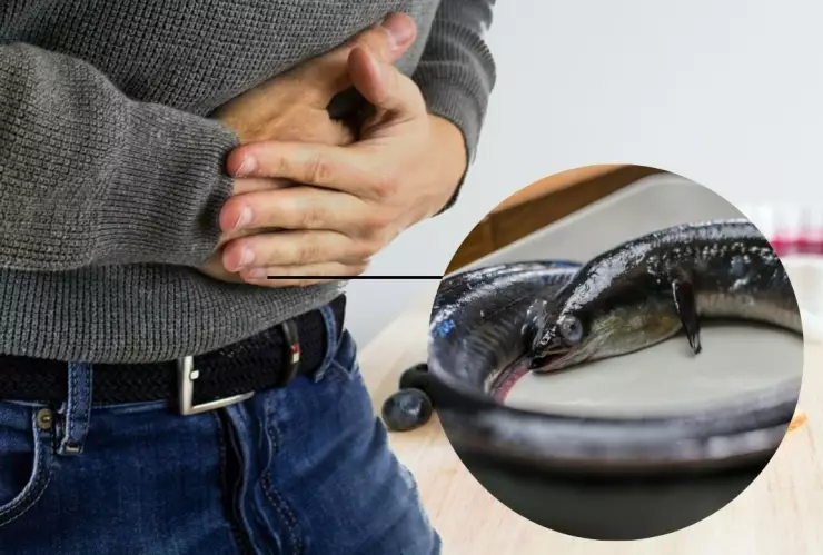 ¡De no creer! Hombre tenía una anguila de 30 centímetros en su estómago; ¿cómo llegó ahí?