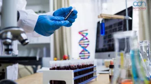  Tratamiento contra el VIH 