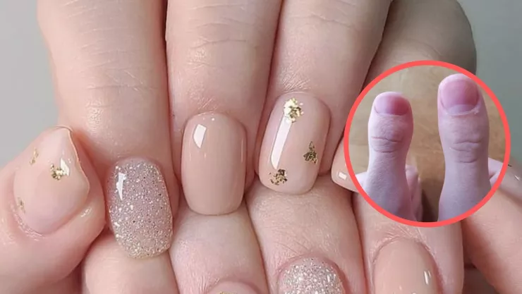 diseño-de-uñas-con-braquilactia